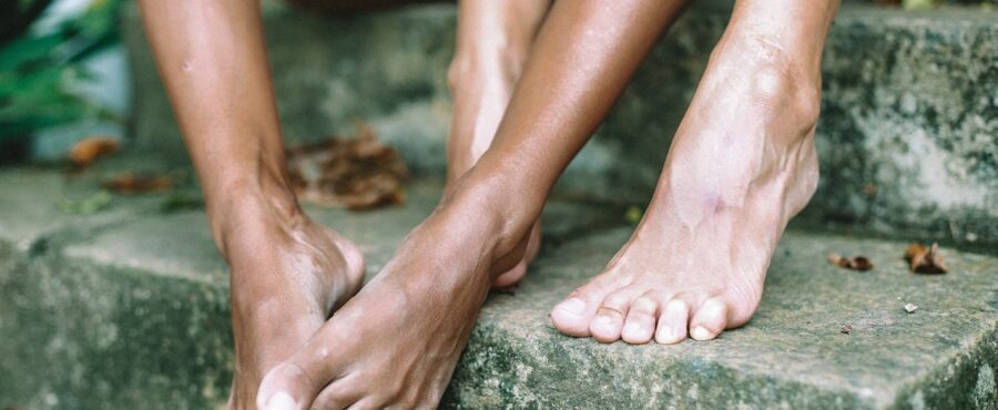 Dieta w chorobie dna moczanowa